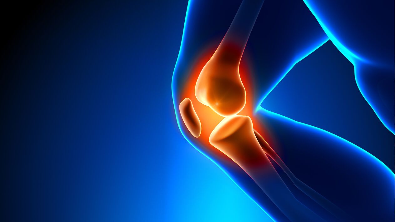 Arthrose der Gelenke